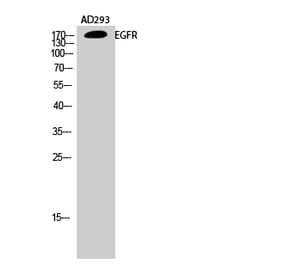 Western blot - EGFR Polyclonal Antibody from Signalway Antibody (40868) - Antibodies.com
