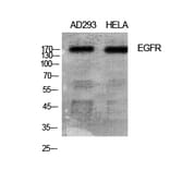Western blot - EGFR Polyclonal Antibody from Signalway Antibody (40868) - Antibodies.com