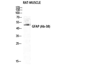 Western blot - GFAP Polyclonal Antibody from Signalway Antibody (40961) - Antibodies.com