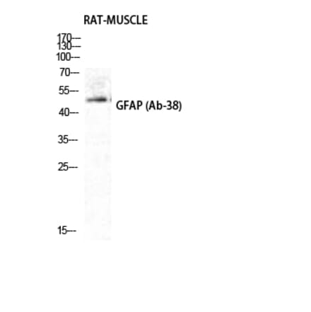 Western blot - GFAP Polyclonal Antibody from Signalway Antibody (40961) - Antibodies.com