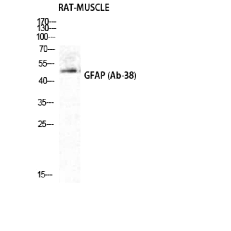 Western blot - GFAP Polyclonal Antibody from Signalway Antibody (40961) - Antibodies.com