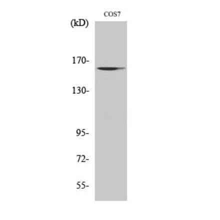 Western blot - GTBP Polyclonal Antibody from Signalway Antibody (40990) - Antibodies.com