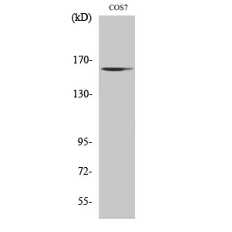 Western blot - GTBP Polyclonal Antibody from Signalway Antibody (40990) - Antibodies.com
