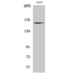 Western blot - GTBP Polyclonal Antibody from Signalway Antibody (40990) - Antibodies.com
