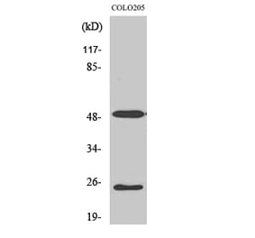 Western blot - LRAT Polyclonal Antibody from Signalway Antibody (41112) - Antibodies.com