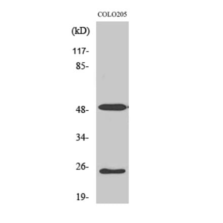 Western blot - LRAT Polyclonal Antibody from Signalway Antibody (41112) - Antibodies.com