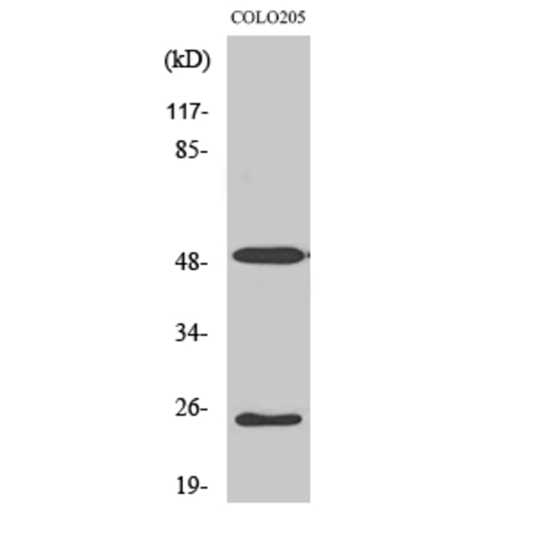 Western blot - LRAT Polyclonal Antibody from Signalway Antibody (41112) - Antibodies.com