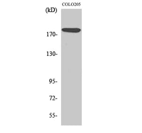 Western blot - MADD Polyclonal Antibody from Signalway Antibody (41118) - Antibodies.com