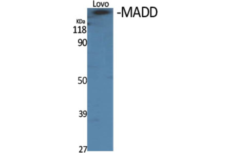 Western blot - MADD Polyclonal Antibody from Signalway Antibody (41118) - Antibodies.com