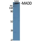 Western blot - MADD Polyclonal Antibody from Signalway Antibody (41118) - Antibodies.com