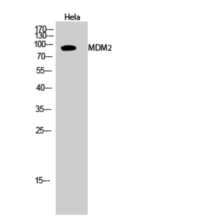 Western blot - MDM2 Polyclonal Antibody from Signalway Antibody (41127) - Antibodies.com