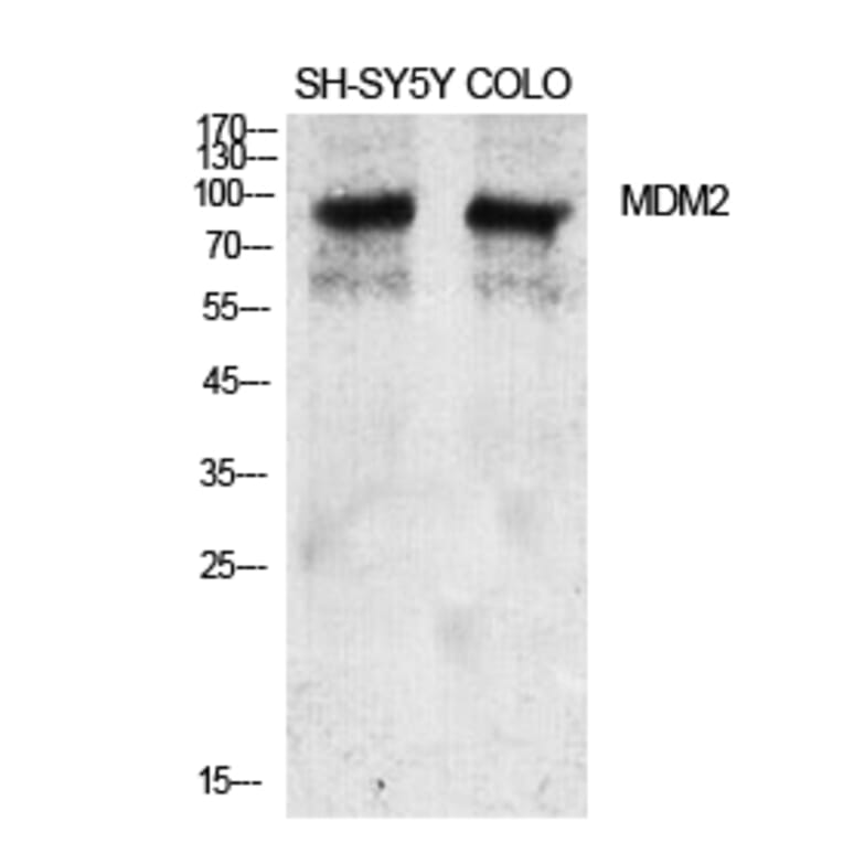 Western blot - MDM2 Polyclonal Antibody from Signalway Antibody (41127) - Antibodies.com