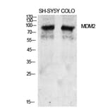 Western blot - MDM2 Polyclonal Antibody from Signalway Antibody (41127) - Antibodies.com