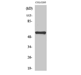 Western blot - MITF Polyclonal Antibody from Signalway Antibody (41145) - Antibodies.com