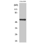 Western blot - MITF Polyclonal Antibody from Signalway Antibody (41145) - Antibodies.com