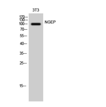 Western blot - NGEP Polyclonal Antibody from Signalway Antibody (41238) - Antibodies.com