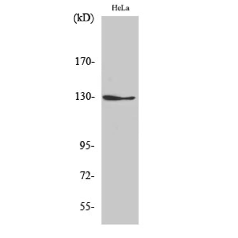 Western blot - NOS2 Polyclonal Antibody from Signalway Antibody (41250) - Antibodies.com