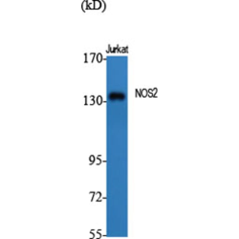 Western blot - NOS2 Polyclonal Antibody from Signalway Antibody (41250) - Antibodies.com
