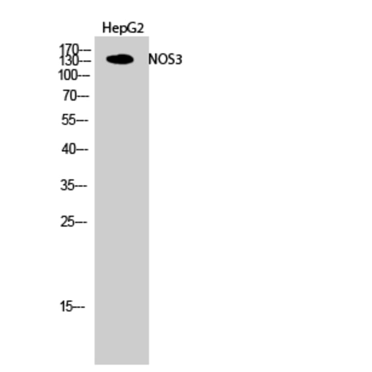 Western blot - NOS3 Polyclonal Antibody from Signalway Antibody (41251) - Antibodies.com