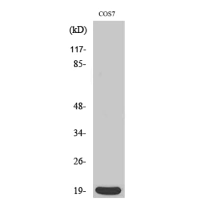 Western blot - Op18 Polyclonal Antibody from Signalway Antibody (41288) - Antibodies.com