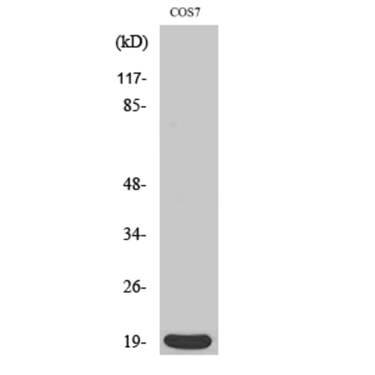 Western blot - Op18 Polyclonal Antibody from Signalway Antibody (41288) - Antibodies.com