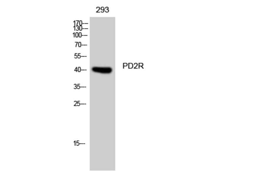 Western blot - PD2R Polyclonal Antibody from Signalway Antibody (41326) - Antibodies.com