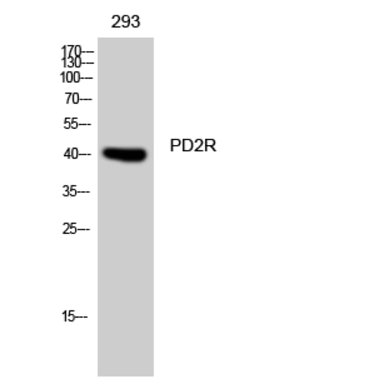 Western blot - PD2R Polyclonal Antibody from Signalway Antibody (41326) - Antibodies.com
