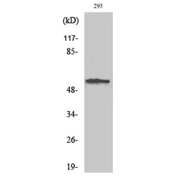 Western blot - SGK1 Polyclonal Antibody from Signalway Antibody (41430) - Antibodies.com