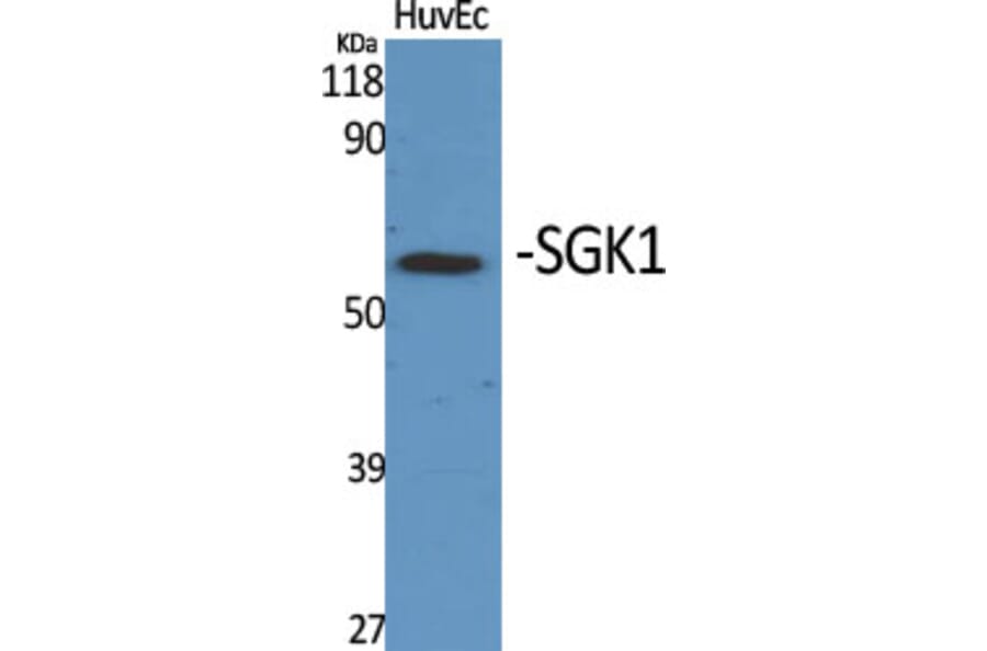 Western blot - SGK1 Polyclonal Antibody from Signalway Antibody (41430) - Antibodies.com