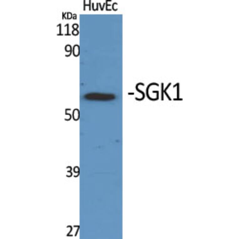 Western blot - SGK1 Polyclonal Antibody from Signalway Antibody (41430) - Antibodies.com