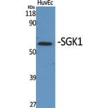 Western blot - SGK1 Polyclonal Antibody from Signalway Antibody (41430) - Antibodies.com