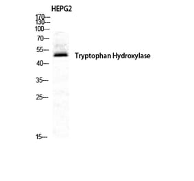 Western blot - TPH1 Polyclonal Antibody from Signalway Antibody (41508) - Antibodies.com