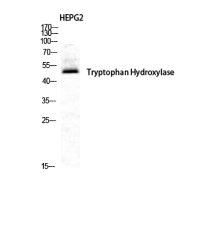 Western blot - TPH1 Polyclonal Antibody from Signalway Antibody (41508) - Antibodies.com
