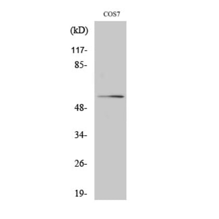 Western blot - Akt Polyclonal Antibody from Signalway Antibody (40570) - Antibodies.com