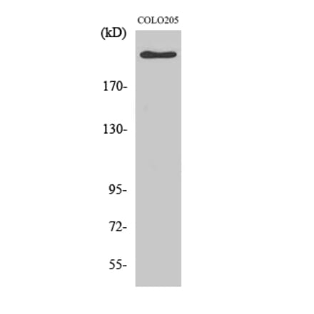 Western blot - APC Polyclonal Antibody from Signalway Antibody (40601) - Antibodies.com