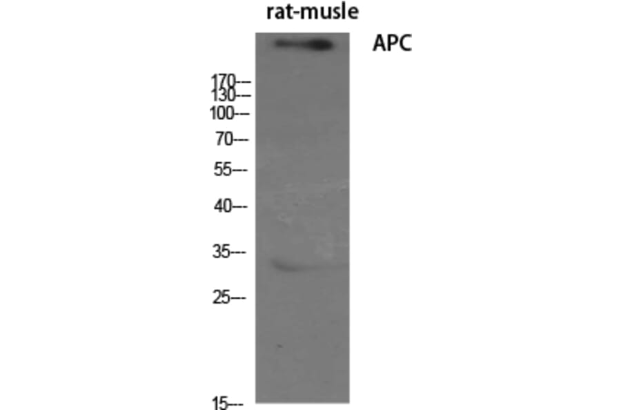 Western blot - APC Polyclonal Antibody from Signalway Antibody (40601) - Antibodies.com