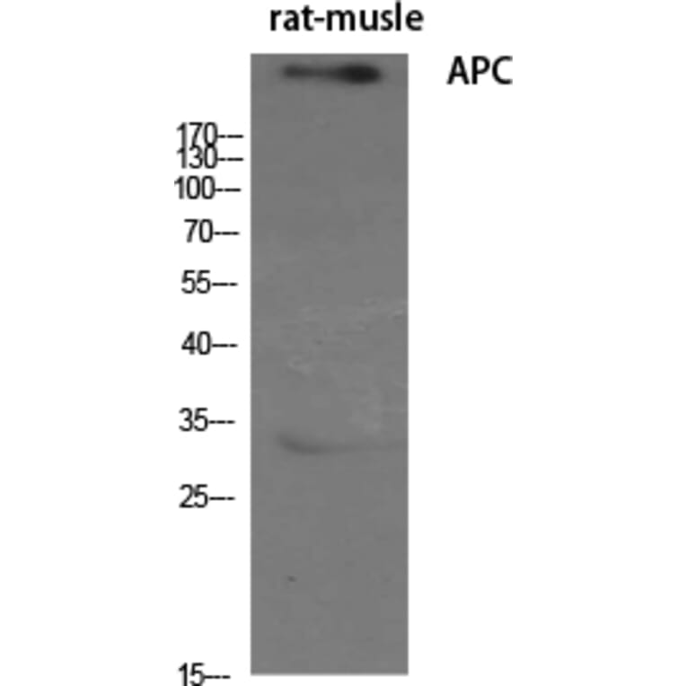 Western blot - APC Polyclonal Antibody from Signalway Antibody (40601) - Antibodies.com