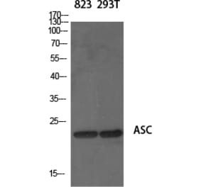 Western blot - ASC Polyclonal Antibody from Signalway Antibody (40618) - Antibodies.com