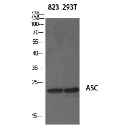 Western blot - ASC Polyclonal Antibody from Signalway Antibody (40618) - Antibodies.com