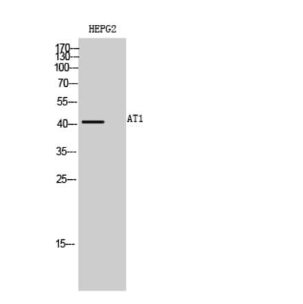 Western blot - AT1 Polyclonal Antibody from Signalway Antibody (40620) - Antibodies.com