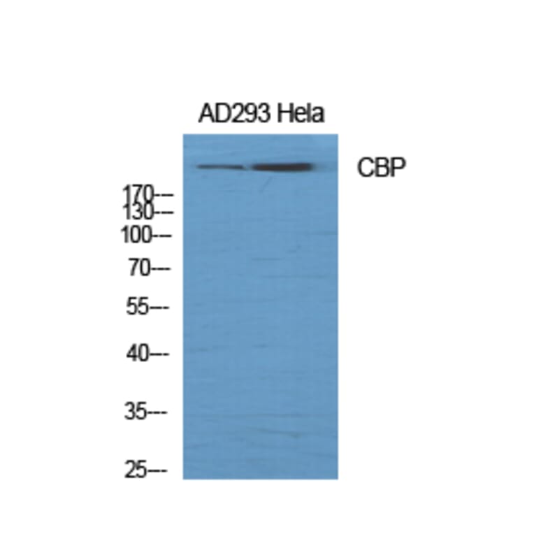 Western blot - CBP Polyclonal Antibody from Signalway Antibody (40686) - Antibodies.com