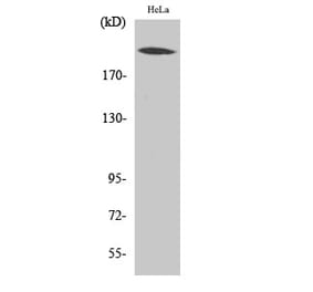 Western blot - CBP Polyclonal Antibody from Signalway Antibody (40687) - Antibodies.com