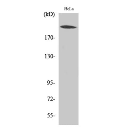 Western blot - CBP Polyclonal Antibody from Signalway Antibody (40687) - Antibodies.com