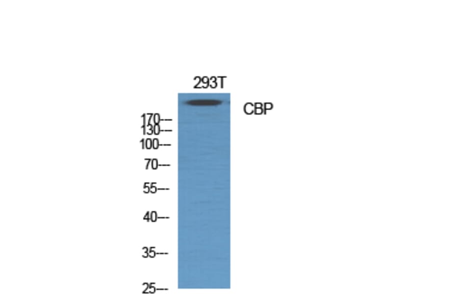 Western blot - CBP Polyclonal Antibody from Signalway Antibody (40687) - Antibodies.com