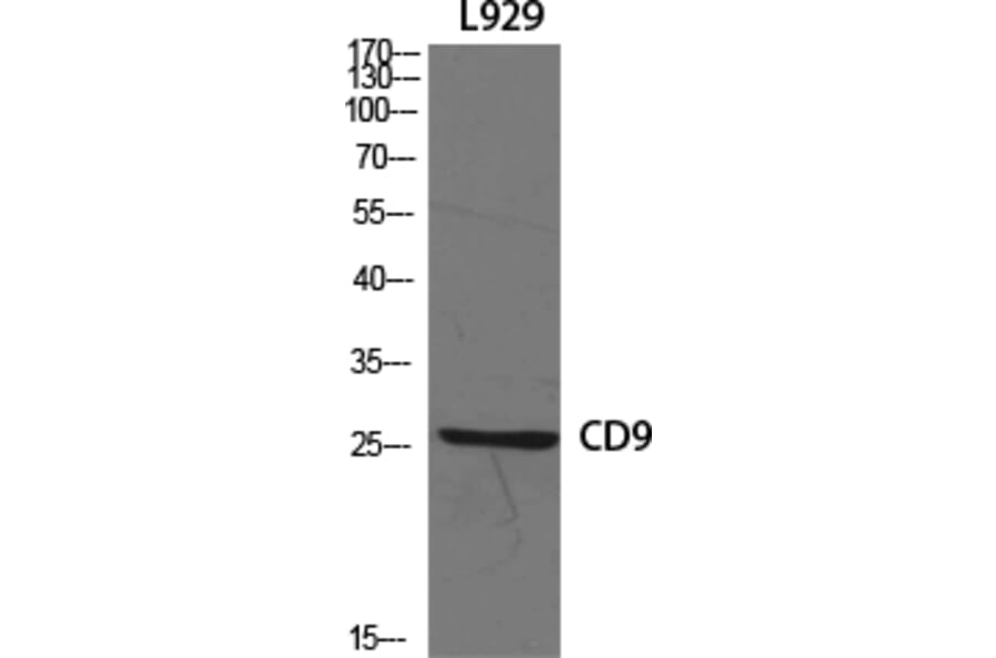 Western blot - CD9 Polyclonal Antibody from Signalway Antibody (40708) - Antibodies.com