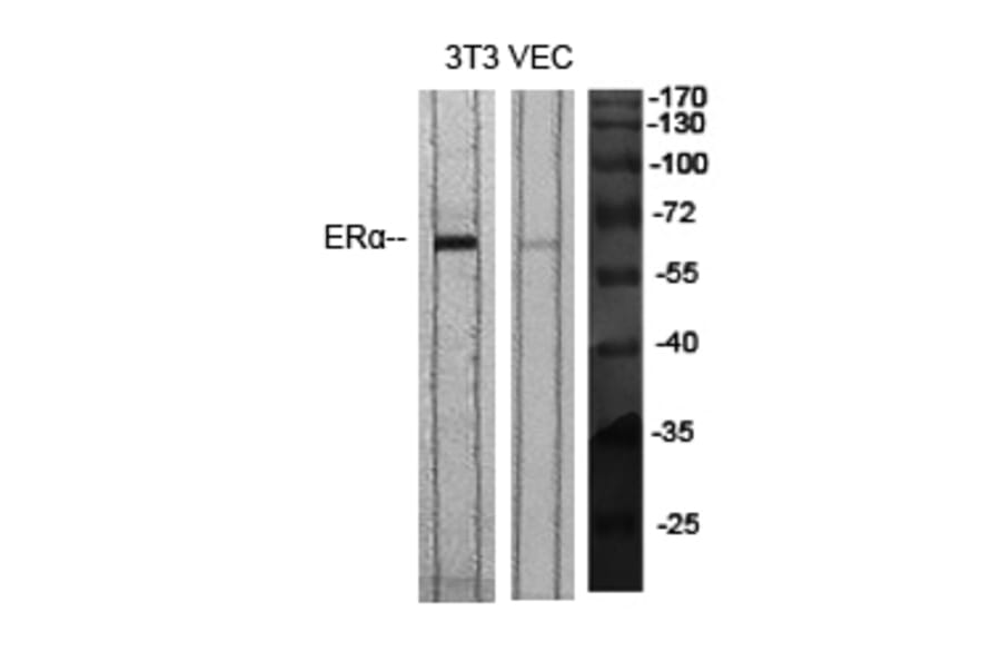 Western blot - ERα Polyclonal Antibody from Signalway Antibody (40907) - Antibodies.com
