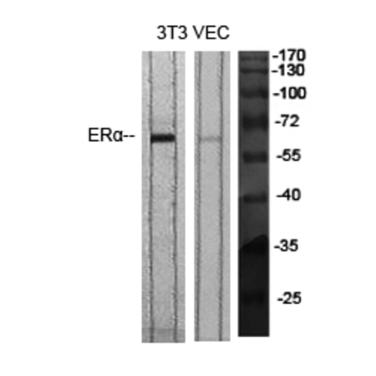 Western blot - ERα Polyclonal Antibody from Signalway Antibody (40907) - Antibodies.com