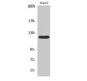 Western blot - FAK Polyclonal Antibody from Signalway Antibody (40913) - Antibodies.com
