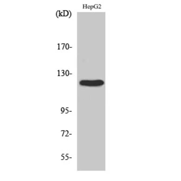 Western blot - FAK Polyclonal Antibody from Signalway Antibody (40913) - Antibodies.com