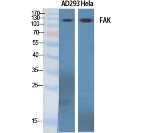 Western blot - FAK Polyclonal Antibody from Signalway Antibody (40917) - Antibodies.com
